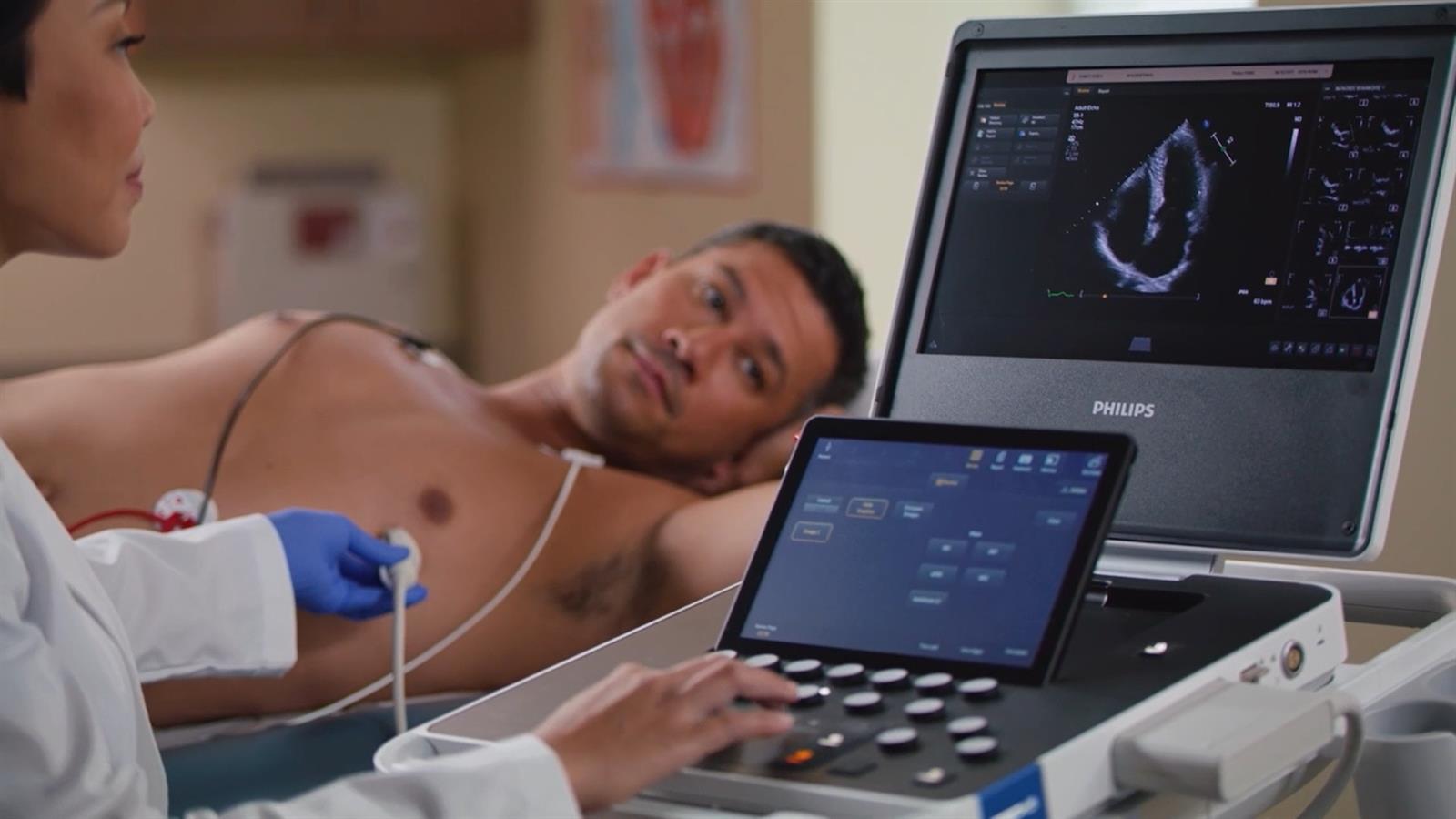 Philips reduce un 71% sus pérdidas en 2023, hasta 466 millones