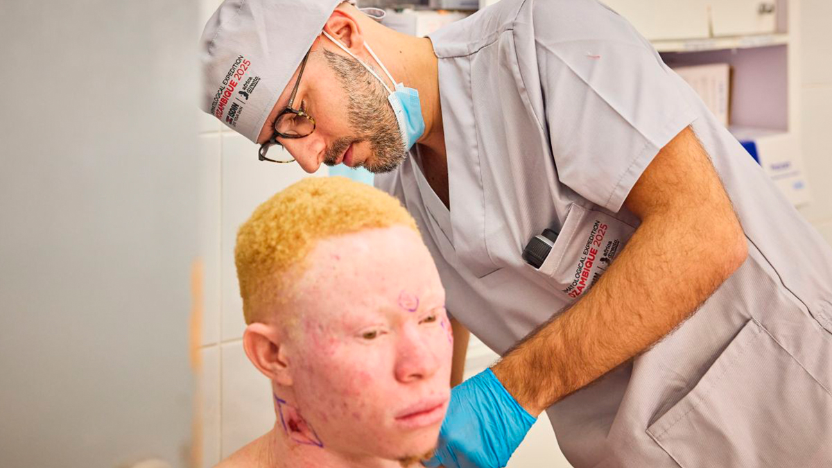 ISDIN y África Directo superan las 5.200 personas con albinismo atendidas en Mozambique contra el cáncer de piel