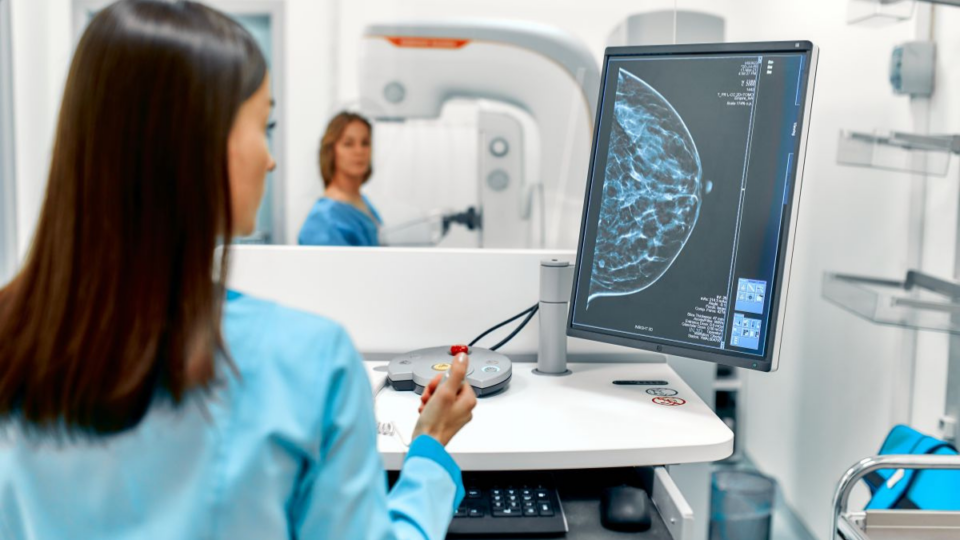 El riesgo de recaída es la principal preocupación sobre el futuro para el 84% de las pacientes con cáncer de mama precoz HR+/HER2-